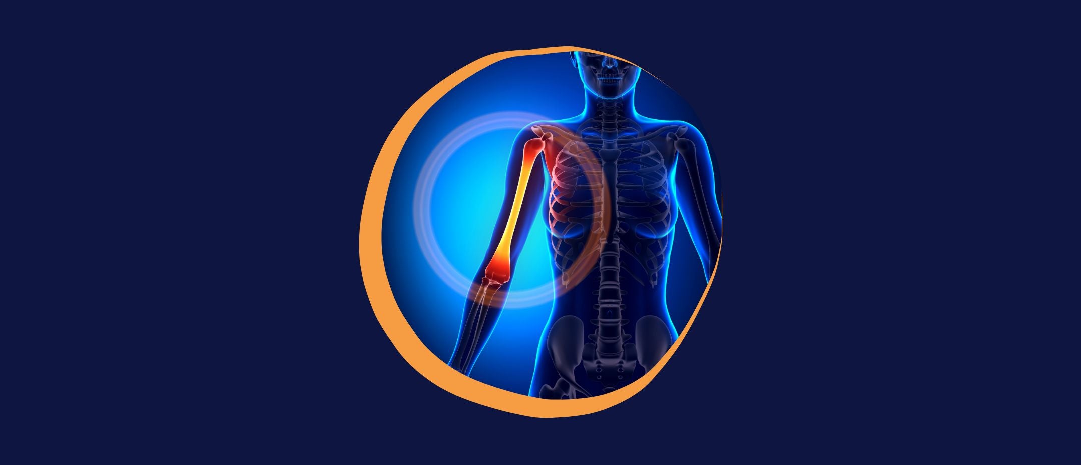 a design targeting the radiology of a humerus fracture